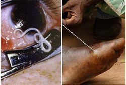 7 Parasit Paling Mengerikan, Pemakan Lidah Hingga Cacing Bola Mata