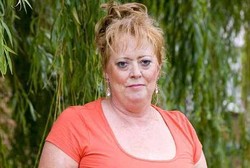 Tenggak 350 Botol Alkohol Seminggu, Patricia Derita Sirosis Hati Parah