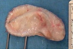 Ilmuwan Ciptakan Telinga Buatan dari Tulang Rawan Domba dan Printer 3D