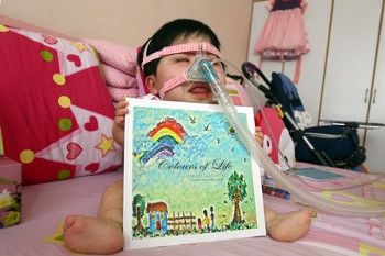 Inilah Pei Shan, Gadis 15 Tahun yang Terperangkap di Tubuh Balita