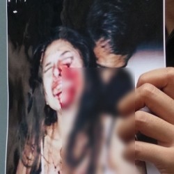 Saat Dikeroyok, Nikita Mirzani Ngaku Dapat Pelecehan dari Pria Tak Dikenal