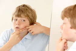 Jerawat Kini Tak Hanya Masalah Remaja, Tetapi Juga Anak SD 