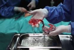 Di Tangan Seniman, Belut pun Disulap Jadi Organ Tubuh Manusia