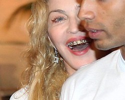 Kencan dengan Berondong, Madonna Pamer Kawat Gigi Bertabur Berlian