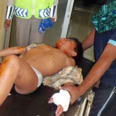 Main Petasan Bantingan, Pelajar SD Kehilangan Dua Jari Tangan