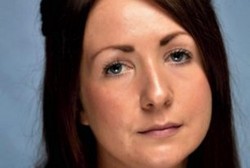 8 Tahun Rutin Tanning, Kini Leanne Harus Berjuang Lawan Kanker Kulit