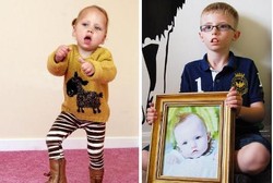 6 Kisah Manusia Tanpa Ekspresi, Terlahir Tanpa Bisa Tersenyum