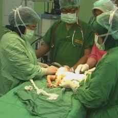 Operasi Pemisahan 10 Menit, Satu Bayi Kembar Siam Probolinggo Meninggal