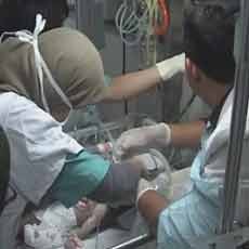 Kondisi Kritis, Bayi Kembar Siam Asal Probolinggo Jalani Operasi Pemisahan