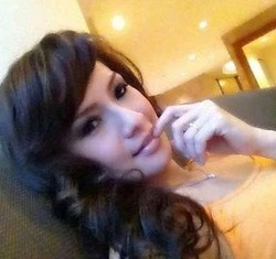 Ini Kata Dokter RSHS Soal Teka-teki Sisca Dijambak atau Tersangkut Gir