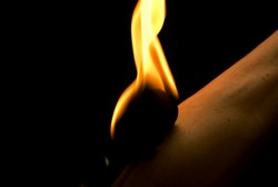 Tubuh Manusia Mendadak Terbakar, Fenomena Mistis Atau Hoax?