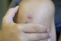 Hii! Kaki Turis Cilik Ini Kemasukan Bekicot Saat Traveling