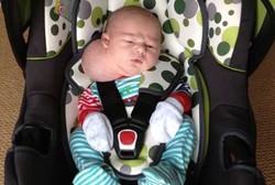 Kista di Leher Bikin Bayi Ini Seperti Berkepala Dua 