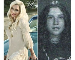 8 Wajah Selebriti Hollywood Saat Masih Remaja, Culun!