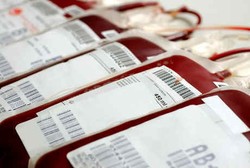 5 Mitos Ketinggalan Zaman Ini Masih Jadi Alasan Hindari Donor Darah