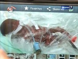 Bayi Kembar Lima Lahir Selamat