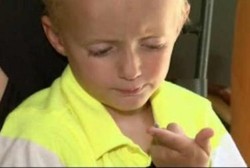 Siput Laut Hidup di Dalam Lutut Bocah Ini Setelah Ia Jatuh di Pantai