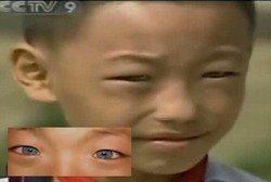 Bocah Bermata Kucing, Bisa Melihat dalam Gelap 