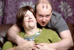 Jatuh di Kamar Mandi, Wanita Ini Malah Kehilangan Separuh Wajah