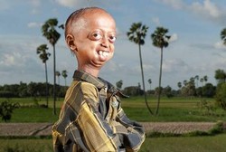 Ali Hussain, Remaja 14 Tahun yang Terlihat Seperti Kakek Pensiunan