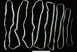 Telan Cacing Pita Bisa Cepat Turunkan Berat Badan? 