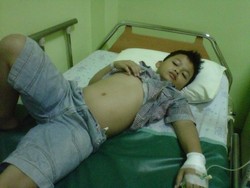 Siswa SD di Depok Babak Belur Dikeroyok 3 Teman, Polisi Turun Tangan