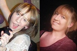 Dibully karena Senyumnya Aneh, Jayella Pasang Otot Paha ke Wajah