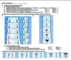 Kisah Kuisioner Vulgar Bagi Siswa SMP di Aceh yang Mendunia