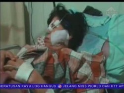 Kesal, Suami Tega Aniaya Nenek Istrinya