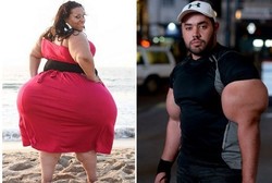 7 Orang dengan Anggota Tubuh Terbesar Sedunia, dari Bibir Hingga Kelamin