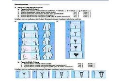 Kisah Kuesioner Vulgar Bagi Siswa SMP di Aceh yang Mendunia