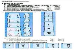 PKBI Dorong Remaja untuk Memahami dan Peduli Organ Reproduksinya