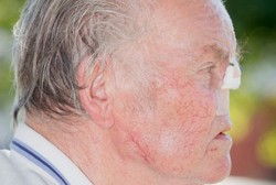 Rp 22 Juta untuk Orang yang Bisa Temukan Hidung Kakek Ini