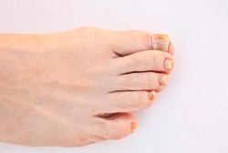 Studi: Kaki di Urutan Terbawah Daftar Bagian Tubuh Terseksi dan Menarik