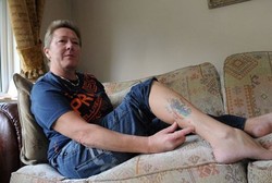 Kedua Kaki Digigit Ular Piton Sepanjang 3 Meter , Wanita Ini Shock