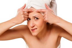 Jerawat di Kulit Laki-laki dan Perempuan, Apa Bedanya?