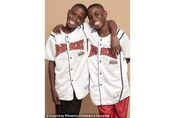 Anemia Kronis, Si Kembar Ini Dapat Sumbangkan Tulang Belakang Adiknya