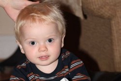  Dikira Tumor, Benjolan di Tenggorokan Bocah Ini Ternyata Kacang