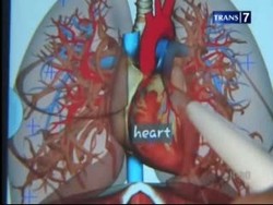 Soal Dul, Ahli Thoraks: Patah Tulang Rusuk Bisa Berdampak Buruk