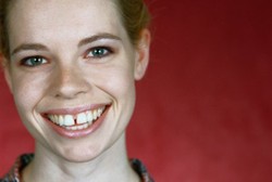 Gigi Renggang, Perlukah Dirapatkan?