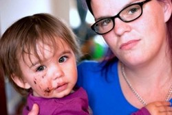 Ingin Bermain, Bocah Ini Malah Luka-luka karena Digigit Anjing