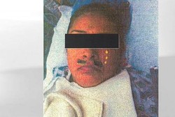 Wajah Ditempeli Stiker Kumis saat Dibius, Pasien Gugat Rumah Sakit