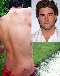 Adik Tiri Kim Kardashian Terluka Saat Surfing di Indonesia 