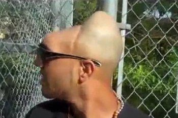 Carlos Halfy Rodriguez, Pria Alien yang Kepalanya Tinggal Separuh