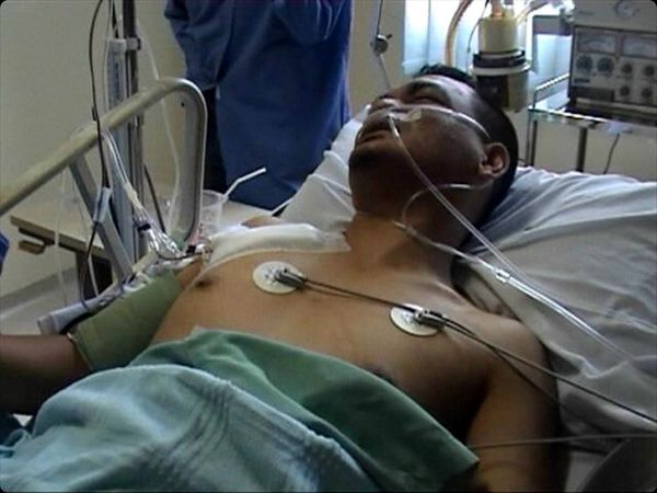 Anggota Polsek Langsa Ditembak Pengedar Sabu