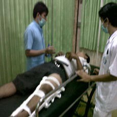 Luka Kaki Brigadir Agung Diduga Ditembak Pelaku Curas