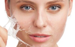 Kulit Kusam dan Kering? Atasi dengan Makan Alpukat dan Yogurt