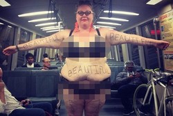 Wanita Berbobot 141 Kg Berbagi Foto agar Lemak Tubuhnya Dianggap Cantik