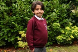 Gangguan Genetik Langka, Bocah 8 Tahun Ini Tampak Seperti Sedang Hamil