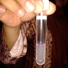 Celup dan Kocok, Ketahuan Deh Makanannya Pakai Formalin atau Boraks 